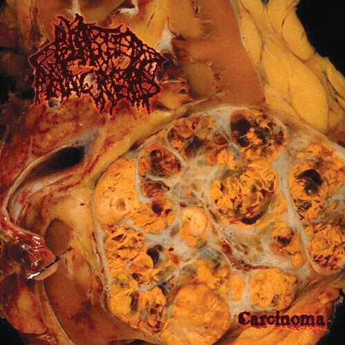 

Виниловая пластинка Blasted Pancreas - Carcinoma