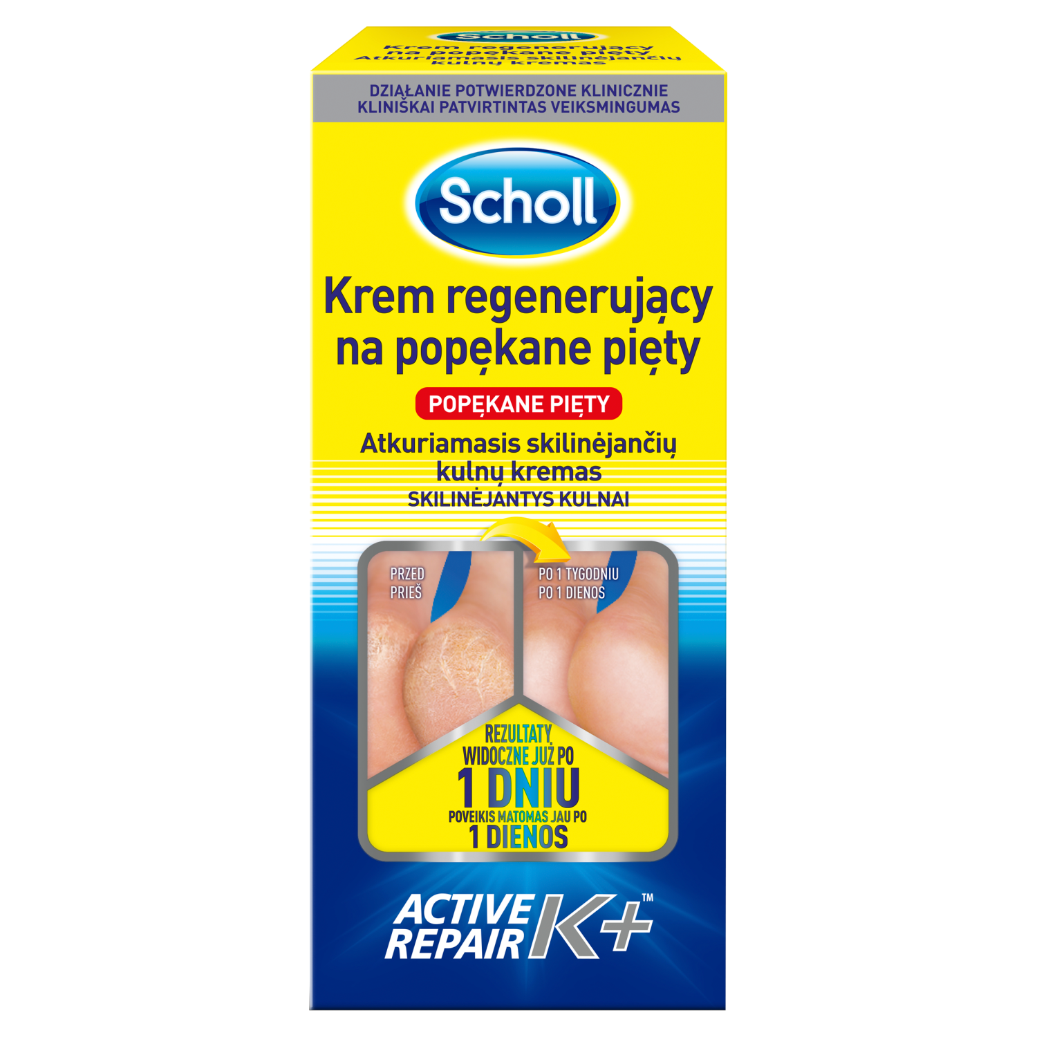 Scholl Active Repair регенерирующий крем от трещин на пятках, 120 мл - фото