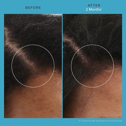 Восстанавливающее средство для ухода за кожей головы, для более густых и здоровых волос, 73 мл, Living Proof