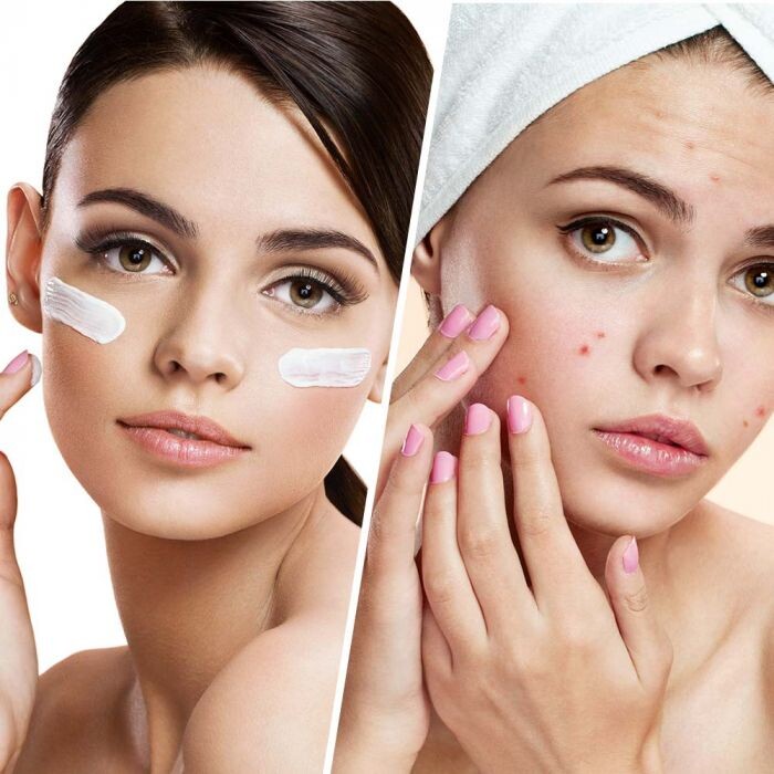 

Крем для лица Crema Facial Imperfecciones Biovène, 50 ml