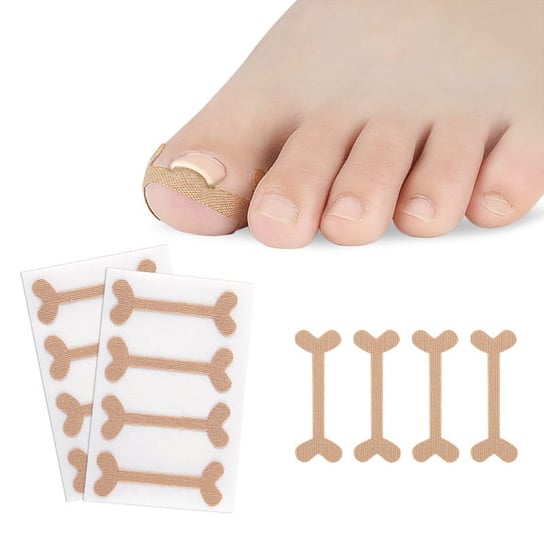 Пластыри для вросших ногтей на ногах, полоски-пряжки, 4 шт. FootService